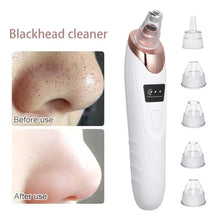 Blackhead Remover